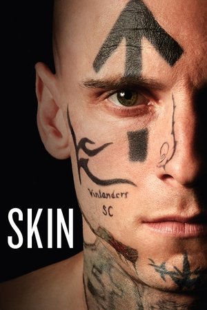 Skin - TopStrem